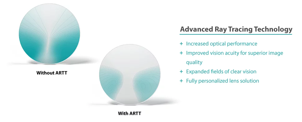 ARTT - atoric optimizaiton benefits